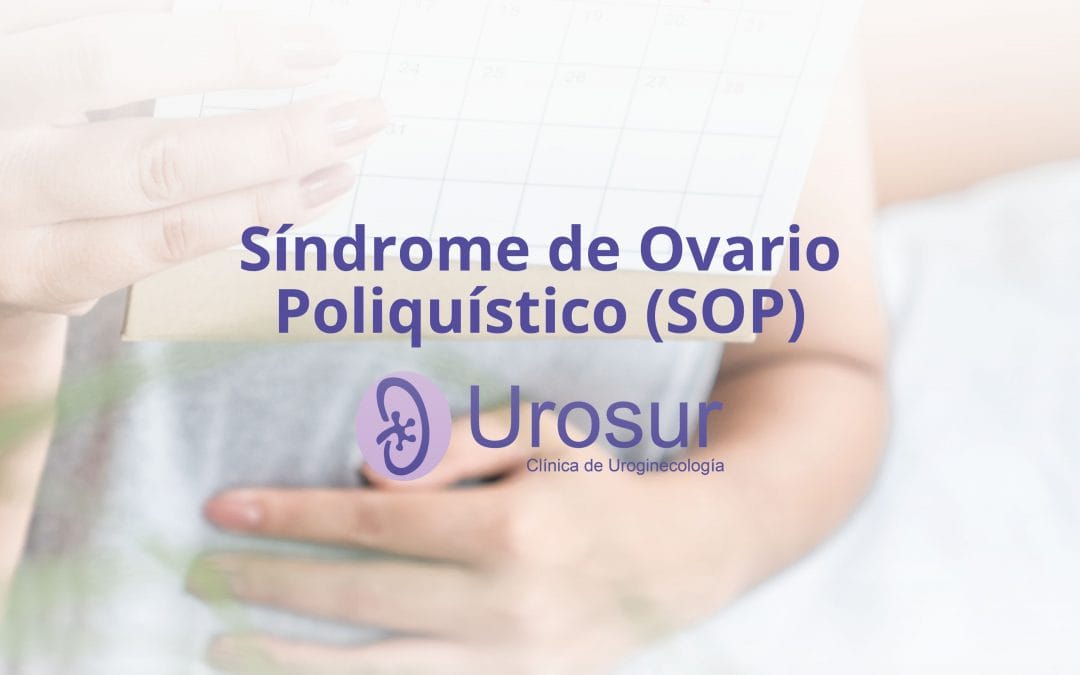 Síndrome de Ovario Poliquístico (SOP): Causas, síntomas y tratamiento