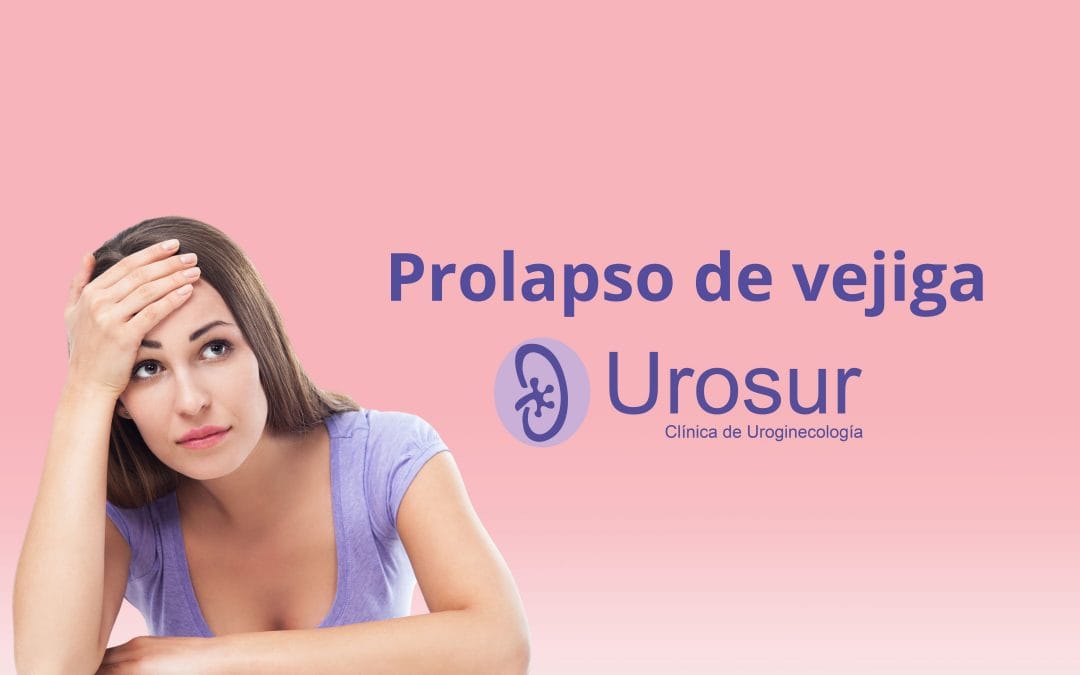 ¿Sientes presión o pesadez en tu zona íntima? Podría ser un prolapso de vejiga (cistocele)