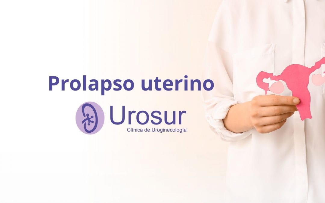 ¿Sientes que algo baja por tu vagina? Conoce el prolapso uterino y sus soluciones