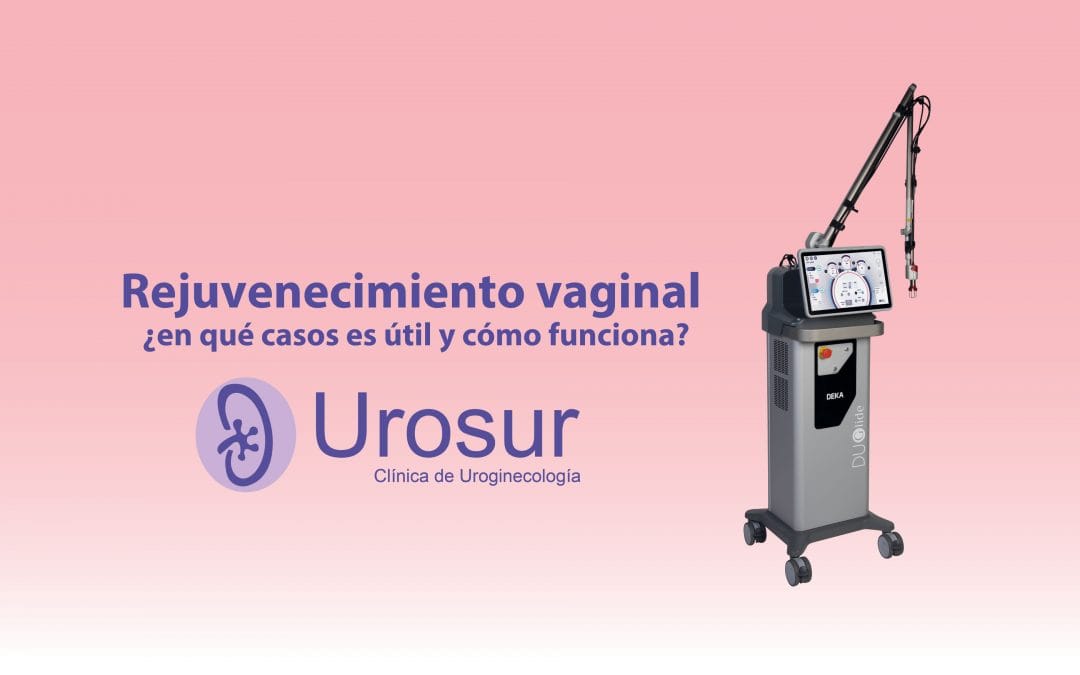 Rejuvenecimiento vaginal con láser CO2: ¿en qué casos es útil y cómo funciona?