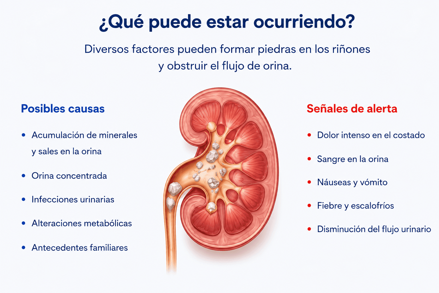 que puede estar ocurriendo - piedras en el riñon - urosur